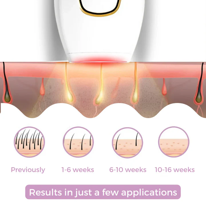 IPL Laser Hair Remover ⁽ˢᵐᵒᵒᵗʰ ˢᵏᶦⁿ ᶠᵒʳ ᴹᵉⁿ & ᵂᵒᵐᵉⁿ⁾ بشرة ناعمة للرجال والنساء