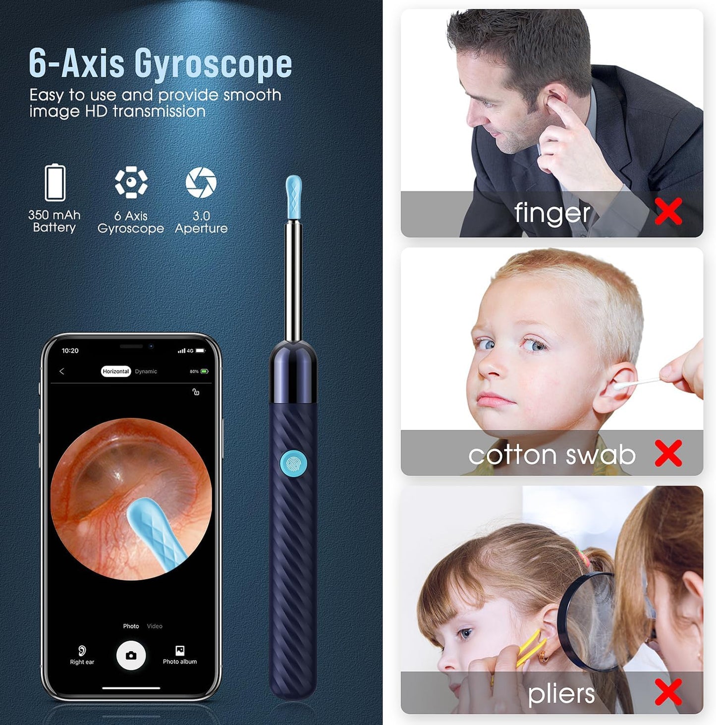 ˢʰᵒᵖʸ Smart Ear Wax Removal Tool,  With Camera & Cleaning Kit