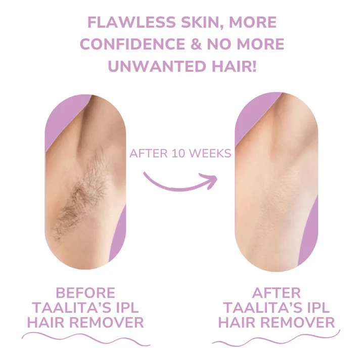 IPL Laser Hair Remover ⁽ˢᵐᵒᵒᵗʰ ˢᵏᶦⁿ ᶠᵒʳ ᴹᵉⁿ & ᵂᵒᵐᵉⁿ⁾ بشرة ناعمة للرجال والنساء
